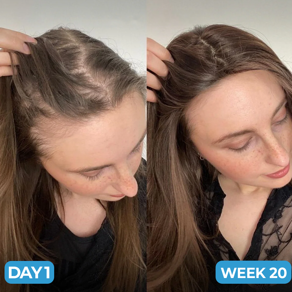 Avernio Scalp Hair Growth Serum