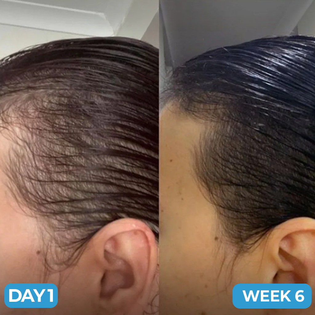 Avernio Scalp Hair Growth Serum